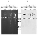 Thumbnail of Plasmid restriction with SmaI (A) and hybridization of isolates carrying the CTX-M-9 enzyme with the CTX-M-9 probe (B). The isolates are as listed in Figure 1. Below each line of hybridization, the pattern shown in the Table is indicated.