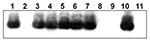 Thumbnail of Southern blot analysis of DNA from rabbit Escherichia coli isolates by using a Shiga toxin 1B (stx1B) probe from rabbit enterohemorrhagic E. coli (EHEC) O153:H-. Lane 1, E. coli O157:H7 DNA (EDL 933, human isolate, positive control); lane 2, No DNA; lanes 3–5, O153:H- DNA (rabbit isolates 01-3014, 02-3283, 02-3300, respectively); lanes 6 and 7, O153:H7 DNA (02-3446 and 02-3301); lanes 8 and 9, O145:H- DNA (02-3282 and 02-3055); lane 10, rabbit isolate of unknown O serotype (03-192);