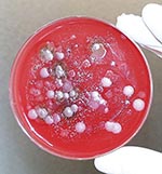 Thumbnail of Fluid collected from the Kameido site cultured on Petri dishes to identify potential Bacillus anthracis isolates.