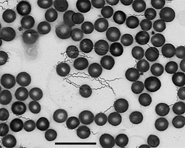 Borrelia hermsii in a thin smear of mouse blood stained with Wright-Giemsa stain and visualized with oil immersion bright-field microscopy (X600) for the confirmation of infection with relapsing fever spirochetes in humans and other animals. Scale bar = 20 μm.