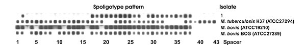 Spoligotype patterns of the isolate obtained from the Siberian tiger: lane 1; spacer sequences 3–16 and 39–43 are absent); lane 2, control strain Mycobacterium tuberculosis H37Rv ATCC 27294; lane 3, control strain M. bovis ATCC 19210; lane 4, M. bovis BCG ATCC 27289.