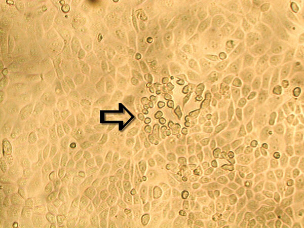 Early cytopathic effect of human metapneumovirus in rhesus monkey kidney (LLC-MK2) cell monolayers. A focus of infected cells that exhibit refractile rounding is indicated by an arrow (100X).