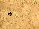 Thumbnail of Late cytopathic effect of human metapneumovirus in rhesus monkey kidney (LLC-MK2) cell monolayers. Infected cells progressed slowly from focal rounding to detachment from cell monolayer is indicated by an arrow (100X).