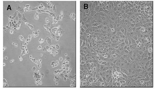 Interferon (IFN)-β 1a inhibition of SARS-CoV cytopathicity in Vero E-6 cells. Vero E-6 cells were infected with the Tor2 isolate of SARS-CoV and incubated for 72 h in the absence (left panel) or presence (right panel) of 500,000 IU of recombinant human IFN-β 1a. Cell rounding and detachment were prominent in the absence of IFN-β 1a. Minimal cell rounding or death was noted in the intact monolayer at 72 h postinoculation in the presence of IFN-β 1a (note: IFN-β 1a administered 1 h postinfection).
