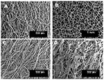 Thumbnail of Environmental scanning electron micrographs of swab material: cotton (A), macrofoam (B), rayon (C), polyester (D).