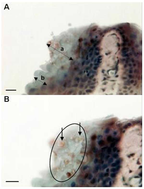 Micrographs of immunoperoxidase stained sections through the interdigital webbing of Xenopus gilli, showing the morphologic features and size of zoosporangia consistent with Batrachochytrium dendrobatidis. A) Arrow a indicates localized hyperplastic epidermal response; arrow b indicates an uninfected region of the epidermis. B) Arrows indicate two zoosporangia with internal septa. Circle indicates location of the infection in the stratum corneum. Bar, 10 μm.