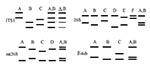 Thumbnail of Schematic representation of the single-strand conformation polymorphism (SSCP) patterns of four variable regions used to type Pneumocystis jirovecii. Each lane corresponds to a hypothetical sample. All simple patterns with two bands for each region are shown. Each uppercase letter represents a simple SSCP pattern. For each region, the complex SSCP pattern A,B corresponding to the superimposition of simple patterns A and B is represented. The complex ITS1 pattern A,B, is demonstrated