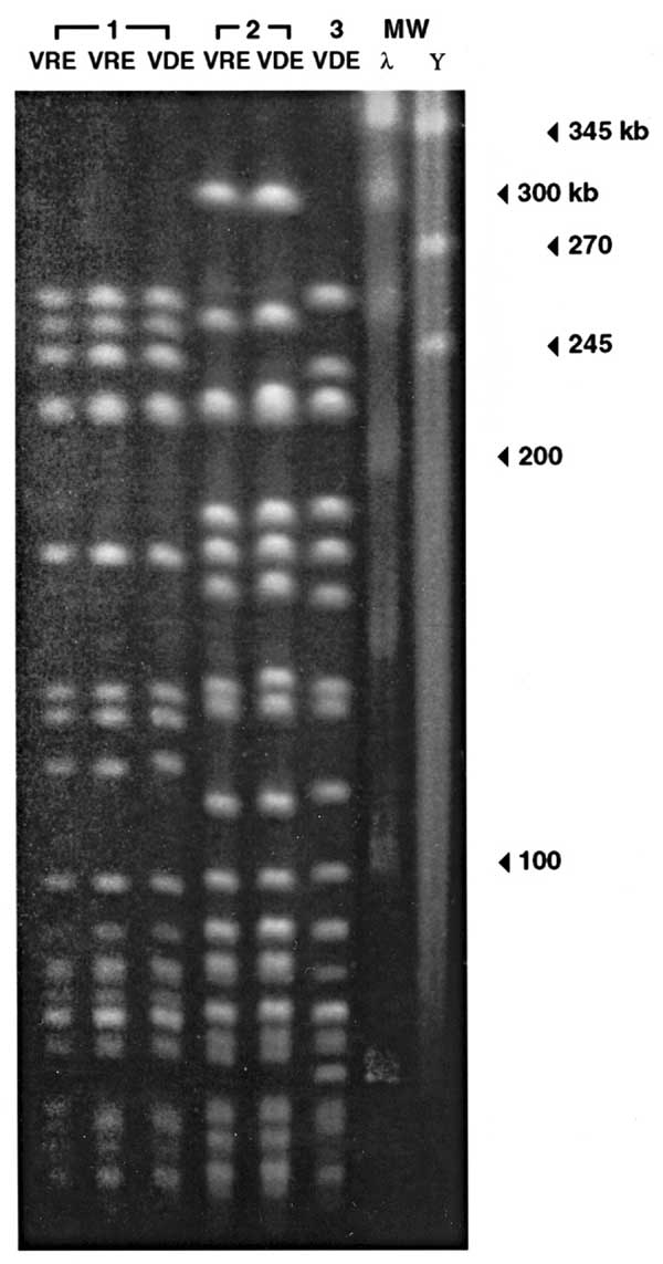 Pulsed-field gel electrophoresis of the three strains of vancomycin-dependent enterococci (VDE) and, in two cases, a vancomycin-resistant enterococci (VRE) strain isolated before the VDE in the same patient. The three VDE strains appear to be genetically distinct, although two may be related. In both cases in which VRE was isolated before VDE, VRE and subsequent VDE strains appear genetically identical. RFLP, restriction fragement length polymorphism; MW, molecular weight; λ, lambda ladder, Y, y