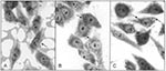 Thumbnail of Patterns of adherence of atypical enteropathogenic Escherichia coli strains (arrows) to HEp-2 epithelial cells. A) aggregative adherence, B) localized-like adherence, and C) indeterminate adherence. Magnification x1,000.