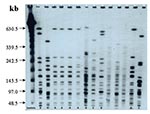 Thumbnail of A typical pulsed-field gel electrophoresis analysis of selected isolates of A. baumannii restricted with ApaI. Lane 1 shows λ ladder used as molecular size marker. Lanes 11–13 are of strains not included in the trial. The gel shows 6 different clones of A. baumannii: 5 isolates belong to clone A and that 2 belong to clone B (the two dominant clones). Single isolates belonging to clones C, D, E, and F can be seen.