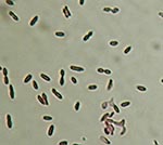 Thumbnail of Gram strain of Clostridium hathewayi from growth on solid agar media. Note the gram-negative staining characteristics and presence of subterminal endospores. Magnification 1000x.