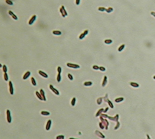Gram strain of Clostridium hathewayi from growth on solid agar media. Note the gram-negative staining characteristics and presence of subterminal endospores. Magnification 1000x.