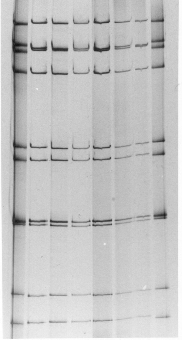 Electrophoretic patterns of the dsRNA of G9P[8] rotavirus strains obtained from Australian children with acute gastroenteritis during the rotavirus outbreak, 2001. Electropherotypes of four representative G9P[8] strains isolated from children during the 2001 rotavirus outbreak are illustrated in part A. Lane 1, Alice Springs (Ob-AS-1); lane 2, Darwin (Ob-Dar-1); lane 3, Gove (Ob-Gv-1); and lane 4, Mount Isa (Ob-Gv-1). B) compares the electropherotypes of G9P[8] strains isolated from children pri