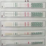 Thumbnail of Results of testing by the VecTest assay. Each strip has a test zone (a) and a positive control zone (b). Samples 1–3 were run in duplicate. Note the difference in band intensity between sample 1 vs. samples 2 and 3 (all three are positive). Sample 4 was a positive control and sample 5 was a negative control.