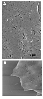Thumbnail of Scanning electron (A) and atomic force (B) microscopy images of uninfected Vero cells. A) Under the scanning electron microscope, uninfected cells look relatively flat with minimal surface morphology. No pronounced pseudopodia are visible on the cell edge or surfaces. B) Atomic force microscopy confirms the form and structure seen in panel A. Cell surface is uniformly flat.