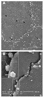 Thumbnail of Scanning electron microscopy of Vero E6 cells infected with severe acute respiratory syndrome–associated coronavirus at 15 h after infection. A) One pronounced surface morphologic change is the proliferation of psuedopodia at the cell periphery (arrows). Some pseudopodia are also developing on the cell surface. Some cells appear to have large amount of extracellular virus on the cell surface (arrowhead), whereas neighboring cells seem deprived of any extracelluar virus particles. B)