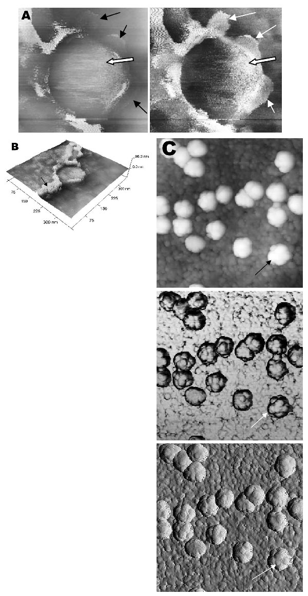 Atomic force microscopy of Vero cells infected with severe acute respiratory syndrome–associated coronavirus at 15 h after infection. A) At much higher resolution imaging of the edge of a cell, a virus particle (thick arrow) in the process of extruding from the cell plasma membrane (PM) after fusion of the transport vesicle with the cell membrane. PM shows some loss of integrity (thin arrows) during this exit process. B) A three-dimensional reconstruction of the extruding virus particle from pan