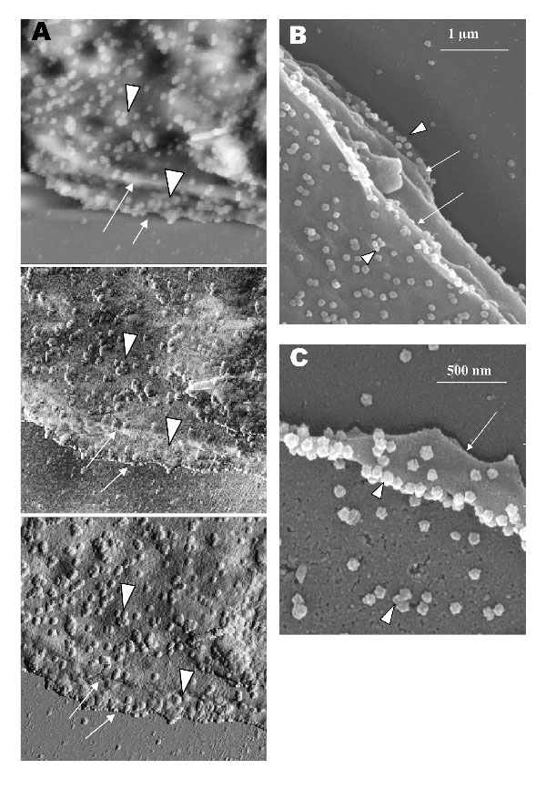 Vero cells infected with severe acute respiratory syndrome–associated coronavirus. A) An atomic force microscopy image of thickened, layered appearance of the edge of the cells (arrows), where active virus extrusion occurs. Arrowheads indicate the virus particles. B) The layered cell edge (arrows) seen by scanning electron microscopy. Virus particles extrude from the layered surfaces.