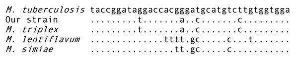 Sequence alignment of the hypervariable region A within the 16s RNA gene of the studied isolate and related species. Mycobacterium tuberculosis was used as the reference sequence. Nucleotides different from those of M. tuberculosis are indicated; dots indicate identity.