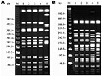 Thumbnail of Pulsed-field gel electrophoresis profiles of the three strains after digestion with XbaI (left) and SpeI (right). Lane M, molecular size markers. Lane 1, porcine strain. Lane 2, bovine strain. Lane 3, human strain. Lane 4, comparison strain Salmonella enterica serovar Typhimurium DT104A with a different resistance pattern. Lane 5, S. Typhimurium DT104L strain with the common pentaresistance pattern.