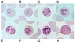 Thumbnail of Giemsa-stained thin blood films depicting A) ring stage, B) tenue form of young trophozoite, C) band-shaped growing trophozoite, D) growing trophozoite with little or no amoeboid activity, E) double growing trophozoites, F) early schizont, G) late schizont in an erythrocyte with fimbriated margins, and H) mature macrogametocyte. Discernible Sinton and Mulligan stippling is in C, D, and F.