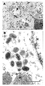 Thumbnail of Ultrastructural localization of monkeypox virus in hepatocytes in the liver of a ground squirrel 5 days after infection. A) Hepatocytes contain numerous groups of virions (arrows) in their cytoplasm (bar = 1 μm). B) Magnified area of A, showing typical ultrastructure of monkeypox virus virions and characteristic hepatocyte mitochondria (M) surrounded by cisterns of granular endoplasmic reticulum (er). N, fragment of hepatocyte nucleus; bar = 0.5 μm.