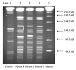 Thumbnail of Pulsed-field gel electrophoresis patterns using restriction enzyme AseI, of Mycobacterium goodii isolates from three patients with postoperative wound infections after receiving surgical implants from a hospital in Colorado. Lane 1 is control strain M. goodii ATCC 700504. Lanes 2–4 are case-isolates. Lane 5 is a 48.5-kb DNA marker.