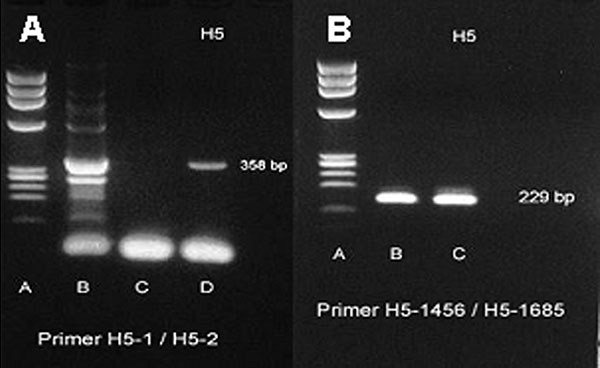 A reverse transcription–polymerase chain reaction (RT-PCR) specific for H5 gene band (358 bp) of avian influenza H5N1 that was recovered from our patient from nasopharyngeal aspirates by using H5-1/H5-2 primer. Lane A, molecular standard; lane B, H5 band isolated from our patient (358 bp); lane C, negative control; lane D, positive control. B. RT-PCR specific for H5 gene band (229 bp) of avian influenza (H5N1) that was recovered from our patient from nasopharyngeal aspiration by using H5-1456/H5