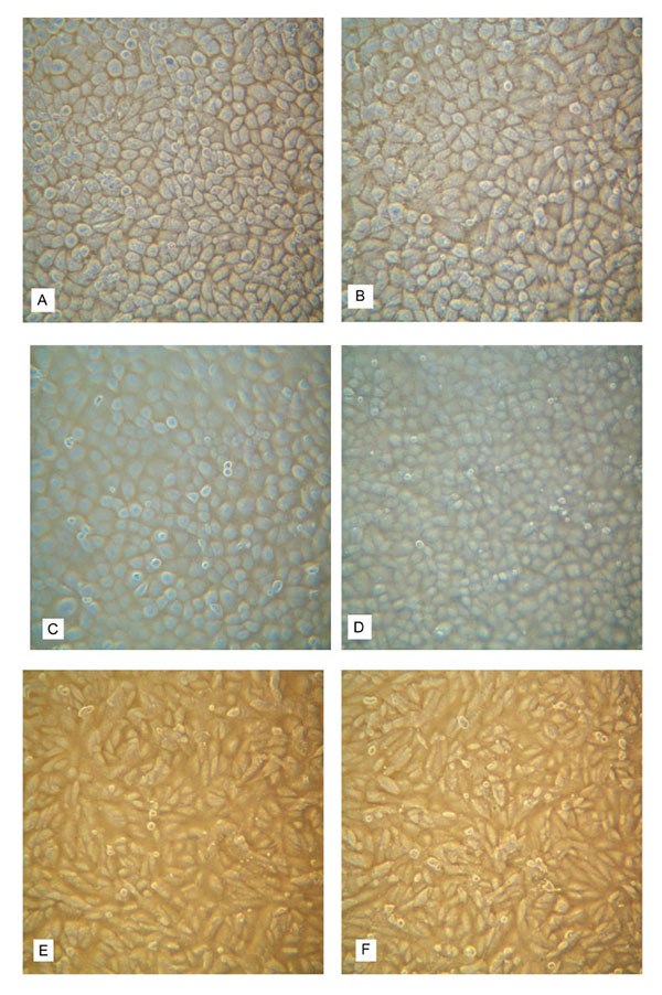 Absence of cytopathic effect after a 7-day exposure of three lines of primate cells (FRhK-4, MA-104, and BGMK) to an inoculum prepared with hemolymph from Taura syndrome virus (TSV)-infected shrimp (Litopenaeus vannamei) during the acute phase of the disease compared to a control inoculum containing hemolymph from specific pathogen free (SPF) shrimp. A) FRhK-4 cells exposed to SPF hemolymph; B) FRhK-4 cells exposed to TSV hemolymph; C) MA-104 cells exposed to SPF hemolymph; D) MA-104 cells expos