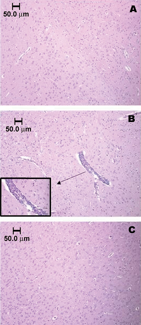 Brainstem section of sham-inoculated control rat, showing the absence of an inflammatory response (A). Vascular and perivascular infiltration of mononuclear cells within the brainstem of a Florida cotton rat 7 days after infection with 3.2 log10 PFU/mL EVEV strain FE4-71k; inset enlarged to show cell infiltration (B). Cortex of cotton rat 5 weeks after infection, showing absence of inflammatory response (C). Animals in panels A and B were anesthetized with pentobarbital and perfused with phospha
