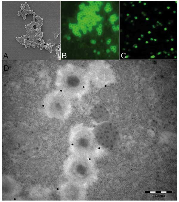 As observed by scanning electronic microscopy, mimivirus antigen (A) is recognized by antibodies in our microimmunofluorescence assay using conventional fluorescence microscope (B) and confocal microscope (C). Mature particles within amebas are also recognized by antibodies seen with transmission electronic microscopy immunogold technique (D) (mimivirus particle size 400 nm).