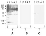 Thumbnail of Western blot performed with a serum sample from a patient with an endocarditis caused by Bartonella quintana. Molecular masses (in kilodaltons) are given to the left of the panels. A) Untreated serum sample analyzed with B. quintana (lane 1), B. henselae (lane 2), B. elizabethae (lane 3), B. vinsonii subsp. arupensis (lane 4), and B. vinsonii subsp. berkhoffii (lane 5) antigens. B) B. quintana–adsorbed serum sample analyzed with B. quintana (lane 1), B. henselae (lane 2), B. elizabe