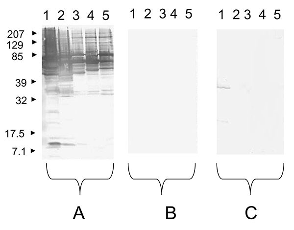 Western blot performed with a serum sample from a patient with an endocarditis caused by Bartonella quintana. Molecular masses (in kilodaltons) are given to the left of the panels. A) Untreated serum sample analyzed with B. quintana (lane 1), B. henselae (lane 2), B. elizabethae (lane 3), B. vinsonii subsp. arupensis (lane 4), and B. vinsonii subsp. berkhoffii (lane 5) antigens. B) B. quintana–adsorbed serum sample analyzed with B. quintana (lane 1), B. henselae (lane 2), B. elizabethae (lane 3)