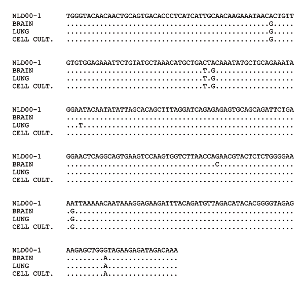 Alignment of 302 nucleotide human metapneumovirus (HMPV) sequences amplified from brain and lung tissues of the patient and from the supernatant of infected Vero cell culture. Sequence of the HMPV strain NLD00-1 was used as a prototype sequence. Conditions of the reverse transcription–polymerase chain reaction were described elsewhere (5).