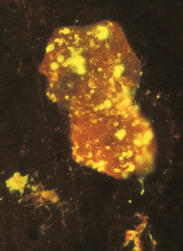 Photomicrograph of a smear of mucopurulent nasal discharge from a monkeypox virus–infected prairie dog (MPX-8), showing a swollen macrophage containing multiple fluorescein-labeled bodies (viral proteins) characteristic of poxvirus infection. Magnification 1,400×.