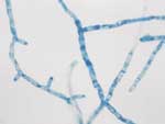 Thumbnail of Slide culture illustrating the broad, branched, and sparsely septate hyphae of Pythium insidiosum (lactophenol cotton-blue, magnification ×40).