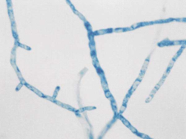 Slide culture illustrating the broad, branched, and sparsely septate hyphae of Pythium insidiosum (lactophenol cotton-blue, magnification ×40).
