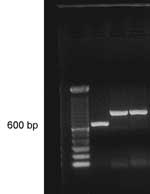 Thumbnail of Polymerase chain reaction with ITS4/ITS5 primers: lane 1, ladder 100 bp; lane 2, positive control showing Pythium brasiliensis band at position 634 bp; lanes 3 and 4, P. insidiosum isolate B01 showing band at position ≈850 bp.