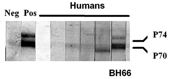 Western blot analysis of human serum samples for evidence of simian foamy virus (SFV) antibodies. Antibodies to the gag precursor proteins (p70/p74) were apparent from the human BH66 blood sample, which indicated infection with SFV. Positive control is an SFV-infected baboon.
