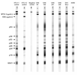 Thumbnail of Representative seroreactivity pattern on Western blot that contains a recombinant GD 21 (common to human T-cell leukemia virus type 1 [HTLV-1] and HTLV-2) and 2 synthetic peptides specific for HTLV-1 (MTA-1) and HTLV-2 (K55). Lane 1, HTLV-1–positive control; lane 2, HTLV-2–positive control; lane 3, HTLV-1/2 negative control; lane 4–9, 6 plasma samples from the HTLV-1–positive women of Ambae Island displaying strong reactivity to GD 21 (faint band for VAN 251), to p19 and p24 (faint 