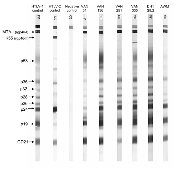 Representative seroreactivity pattern on Western blot that contains a recombinant GD 21 (common to human T-cell leukemia virus type 1 [HTLV-1] and HTLV-2) and 2 synthetic peptides specific for HTLV-1 (MTA-1) and HTLV-2 (K55). Lane 1, HTLV-1–positive control; lane 2, HTLV-2–positive control; lane 3, HTLV-1/2 negative control; lane 4–9, 6 plasma samples from the HTLV-1–positive women of Ambae Island displaying strong reactivity to GD 21 (faint band for VAN 251), to p19 and p24 (faint band for VAN 