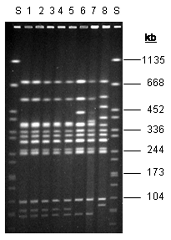Pulsed-field gel electrophoresis patterns of XbaI-digested DNA from Salmonella Agona strains. Lanes 1 and 2, pattern SAX0001 (outbreak strain from tea); lanes 3–5, pattern SAX0001 (outbreak strain from humans); lanes 6–8 (nonoutbreak strains); lane S, molecular mass standard (S. Braenderup). kb, kilobases.
