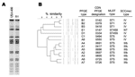 Thumbnail of A) Pulsed-field gel electrophoresis (PFGE) fingerprint of USA400 and PFGE pattern B1. B) Dendrogram showing relationship of the unique fingerprints, along with the PFGE type designation (11) and other molecular characteristics of each subtype. CDN, Canadian Diseases Network; MLST, multilocus sequence typing; SCC, staphylococcal chromosome cassette.