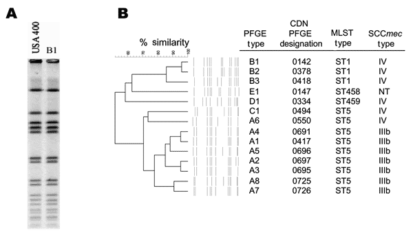 A) Pulsed-field gel electrophoresis (PFGE) fingerprint of USA400 and PFGE pattern B1. B) Dendrogram showing relationship of the unique fingerprints, along with the PFGE type designation (11) and other molecular characteristics of each subtype. CDN, Canadian Diseases Network; MLST, multilocus sequence typing; SCC, staphylococcal chromosome cassette.