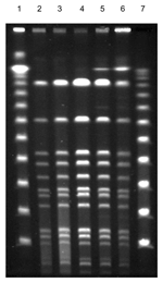 Thumbnail of Fingerprint patterns for different Staphylococcus lugdunensis colony morphotypes, including small-colony variants (SCVs), after pulsed-field gel electrophoresis after digestion with SmaI, showing identical isolates. Lanes 1 and 7, 100-bp ladder; lane 2, blood isolate; lanes 3–5, colony variants; lane 6, SCVs of S. lugdunensis obtained from thrombotic material.