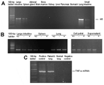 Thumbnail of A) Detection of H5 influenza viral RNA in lungs, intestines, and spleen by reverse transcription-polymerase chain reaction (RT-PCR). B) Strand-specific RT-PCR detected positive-stranded viral RNA only in lungs and intestines but not in spleen. +/–, total RNA; –, negative-stranded RNA; +, positive-stranded RNA. RT-PCR products of an infected cell culture pellet and supernatant are shown as a control for proper amplification of the specific strands (lower panel). C) Tumor necrosis fac