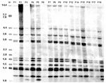 Thumbnail of IS6110 restriction fragment length polymorphism (RFLP) analysis of Mycobacterium tuberculosis isolates from 16 patients associated with the multidrug-resistant tuberculosis outbreak, Bizerte, Tunisia, 2001–2004. Lane M, reference strain MTB14323. Values above each well correspond to each patient as identified in Table 1. Values on the left are in kilobases.