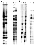 Thumbnail of A) IS6110 restriction fragment length polymorphism (RFLP) analysis (left) and polymorphic GC-rich repetitive sequence (PGRS) typing (right) of patient P11. Lane 1, initial isolate; lane 2, follow-up isolate. B) IS6110 RFLP (left) and PGRS typing (right) of patient P20 (lane 1) compared with patient P3 (lane 2), a typical outbreak-associated patient. Lane M, reference strain MTB14323.