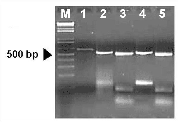 Representative results of groEL heminested polymerase chain reaction (PCR) and HindIII digestion pattern. Lane 1: result of the first PCR round obtained with the strain NCH-1 used as control. Lanes 2, 4: results of the heminested PCR obtained with NCH-1 and with a symptomatic dog, respectively. Lanes 3, 5: HindIII digestions of amplicons shown in lanes 2 and 4, respectively. M:100 bp ladder.
