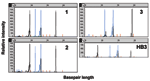 Thumbnail of Capillary electropherograms of Plasmodium microsatellite analysis. The x axis represents fragment size in bases and the y axis represents fluorescence intensity. The P. falciparum microsatellites products C13M30 and PFPK (black peaks) and TA81 and C4M8 (blue peaks) from amplification genomic DNA from patients 1, 2, one of the unrelated patient controls, and control P. falciparum clone HB3. Each microsatellite has ≥10 alleles. Patients 1 and 2 have identical microsatellites at all 4 